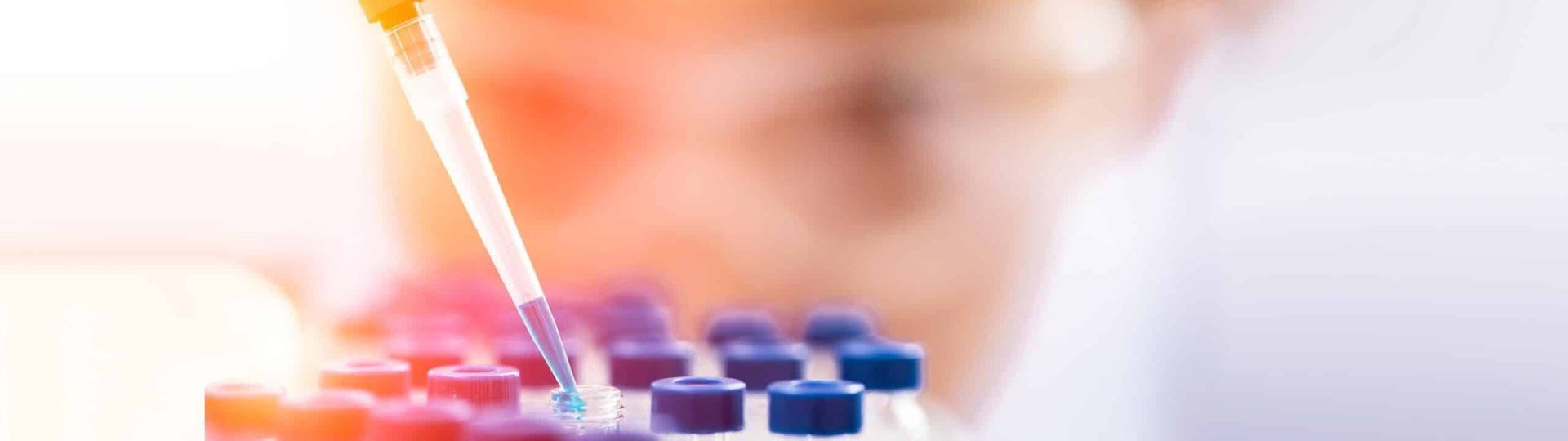 A Scientist is Using a Pipette to Pour Liquid Into a Test Tube — Brisbane Upper GI Surgery in Chermside, QLD