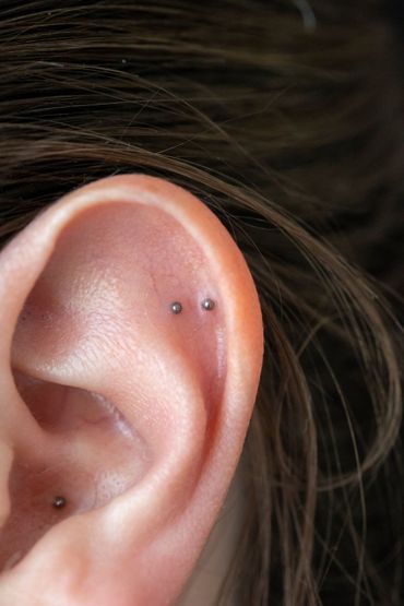 Close-up of an outer ear with ear seeds placed on auricular points for gentle pressure and support.