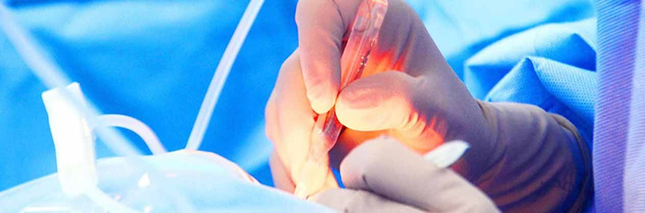 Un primer plano de las manos de un cirujano sosteniendo una aguja en un quirófano.