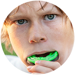 Custom Sports Mouthguards — Alice Denture Clinic in Tunga Court, Alice Springs, NT