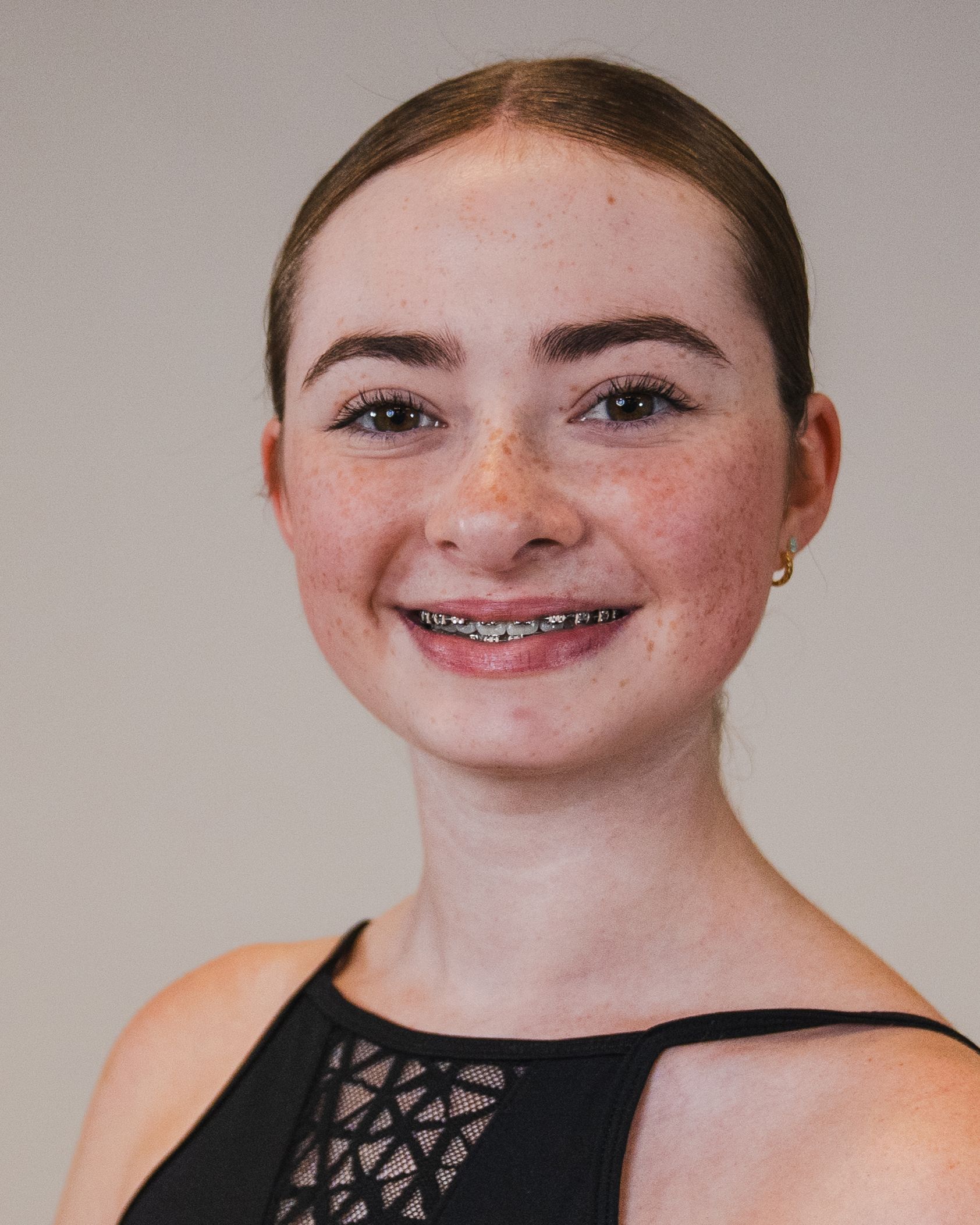 A young woman with braces on her teeth is smiling for the camera.