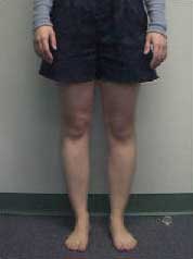 Kinetic chain of the lower extremity