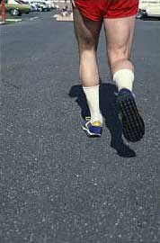 Runner with hyperpronation