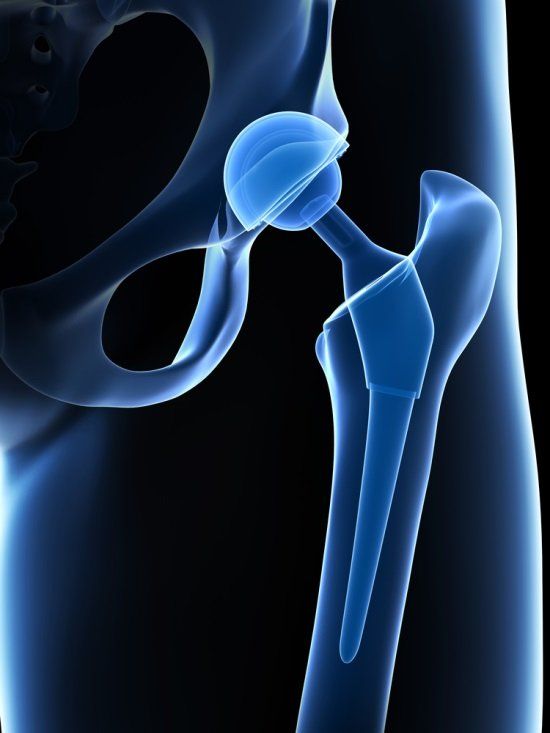 Illustration and x-ray of leg joint