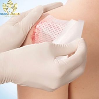 Wound Care, Staple & Stitches Removal