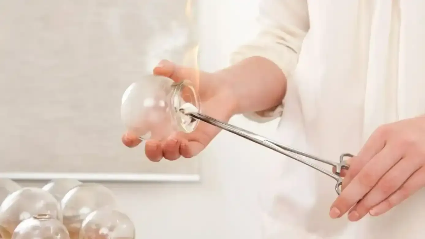 Register Nurse ,CQC certificated provide Fire Cupping Therapy , in London clinic Marylebone area 