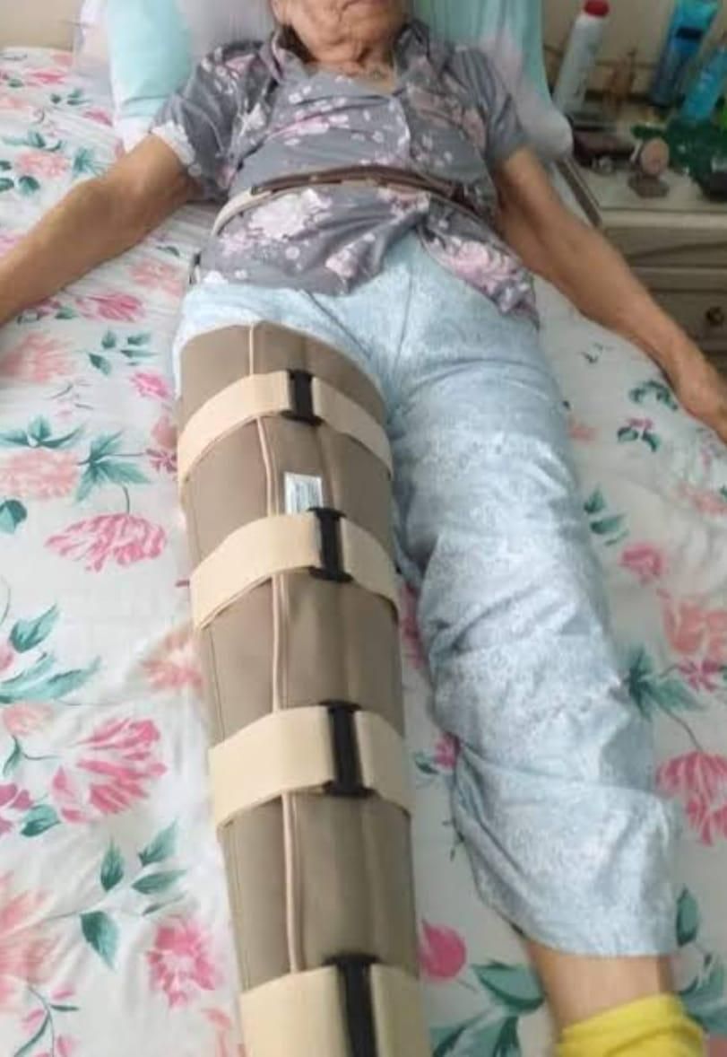 Persona tumbada en una cama con una pierna inmovilizada con una férula ortopédica de color beige y vendajes.