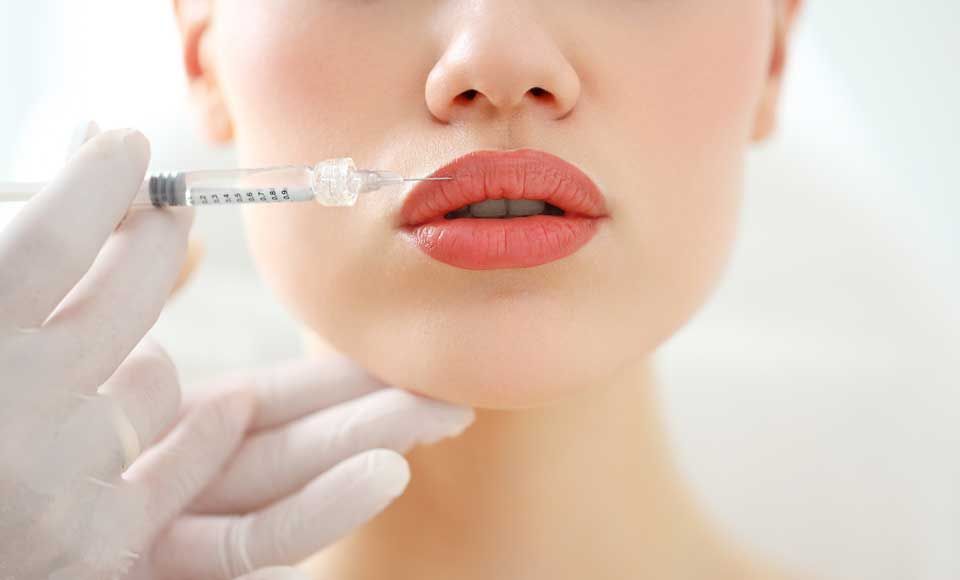 Dermal Fillers – Rhinebeck, NY – La Lume Med Spa