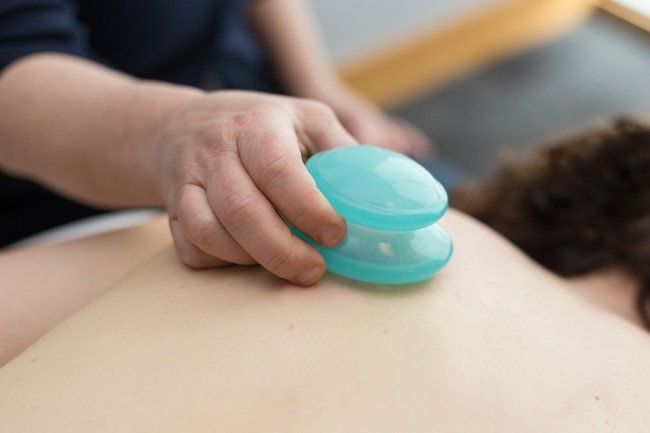 A person is getting a cupping treatment on their back.