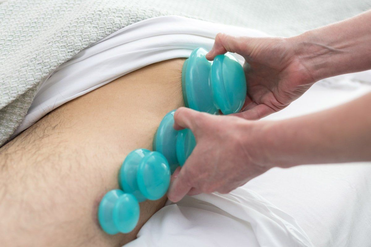 A person is getting a massage with blue cups on their lower back.