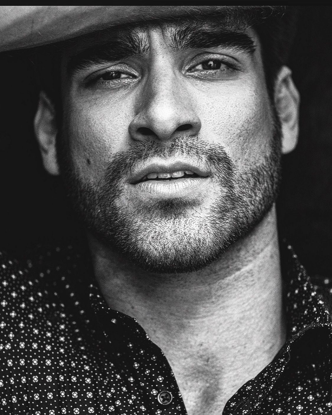 Man with a beard, wearing patterned shirt, hand on forehead, looking toward the viewer.