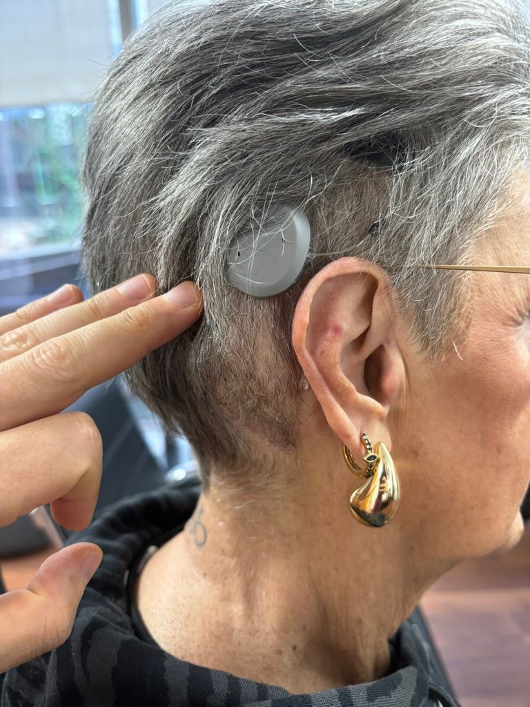 Paciente adulta con implante coclear — Luz Maria S.