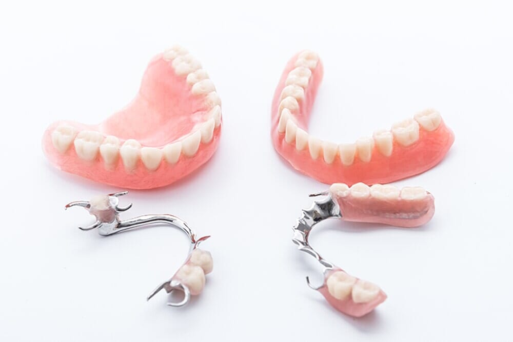 Complimentary Denture Consultation — Denture in Mackay, QLD