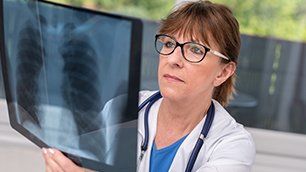 Lungs X-Ray, Asbestos Cases in Charleston, WV