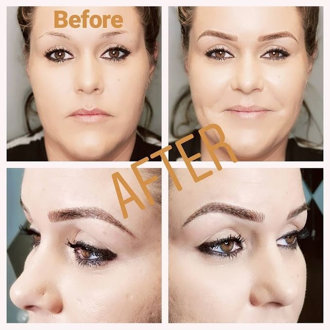 Before and after photos show a woman's eyebrows before and after a cosmetic procedure, with an updated brow shape.