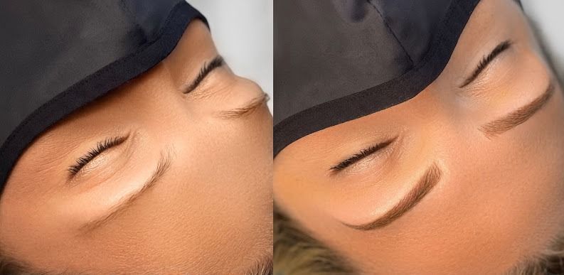 Before and after shot of eyebrows, with no makeup on the left and microbladed eyebrows on the right.