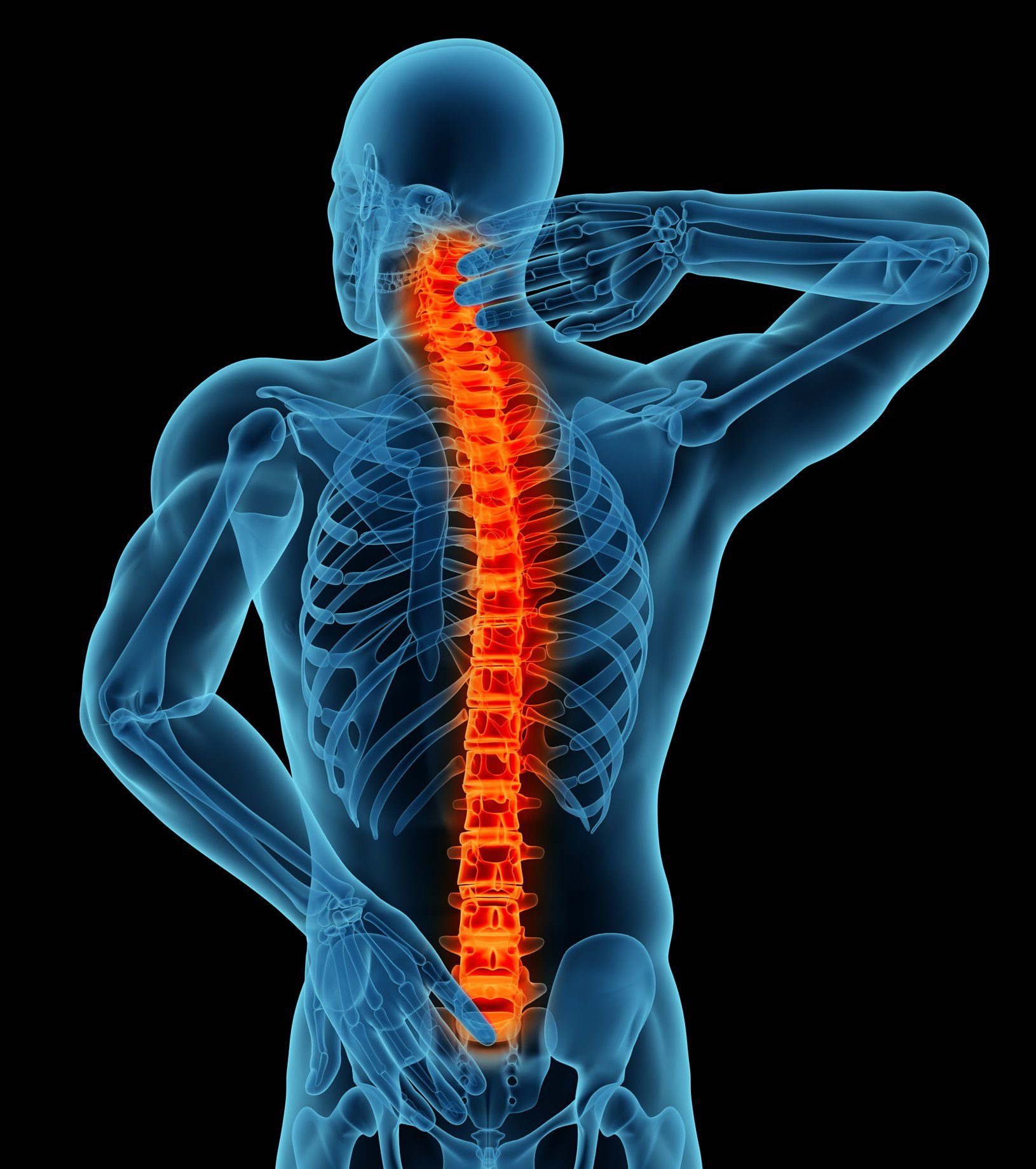 Back Pain X-ray — Clayton, GA — Dr. Carl Lynn, DCC