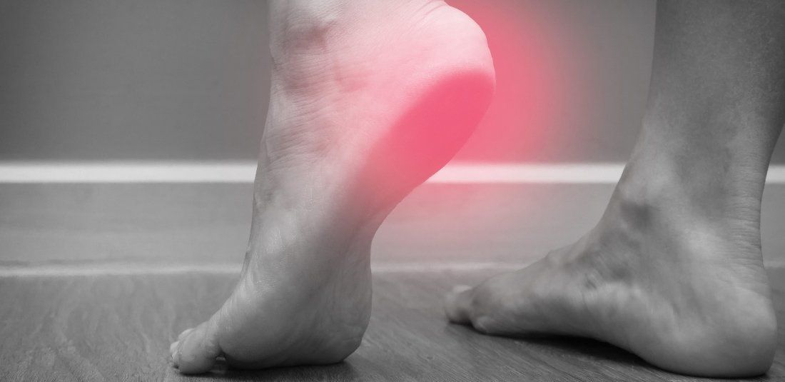 Sciatica \u0026 Heel Pain - What's The Link?