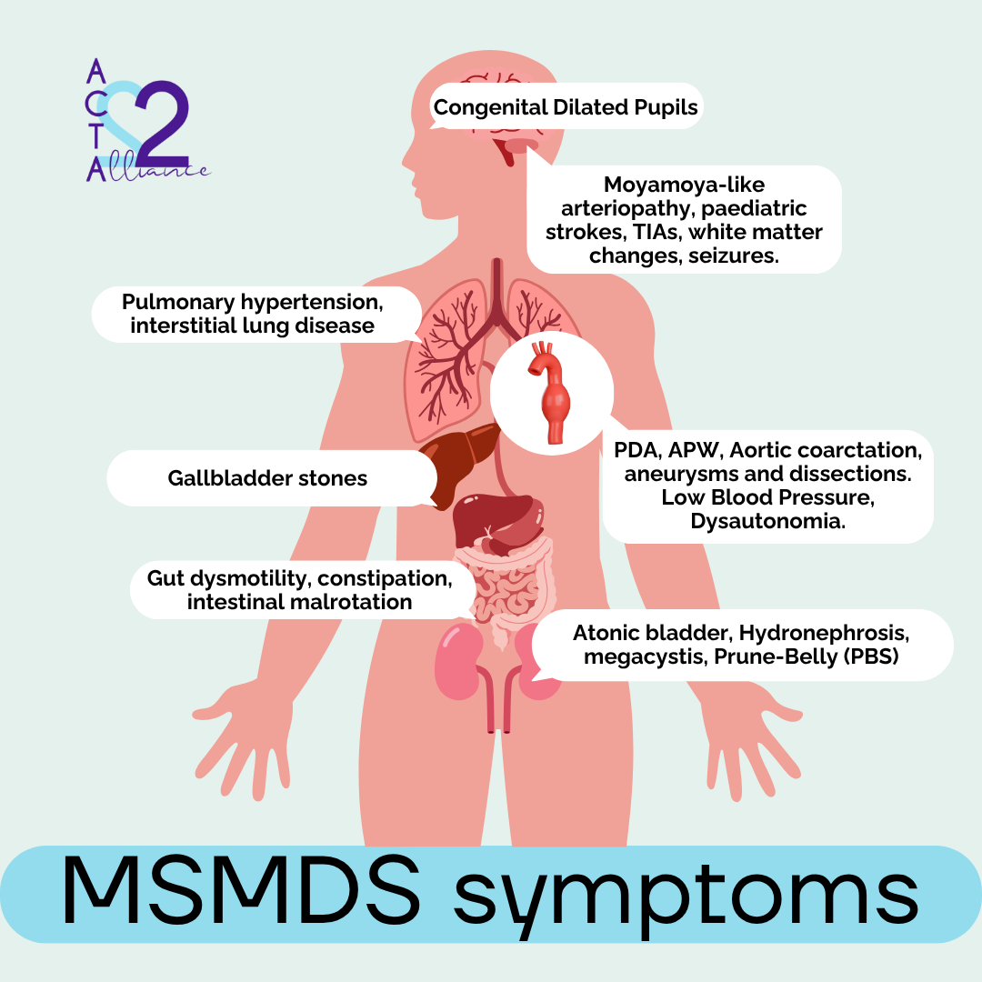Most common symptoms of MSMDS
