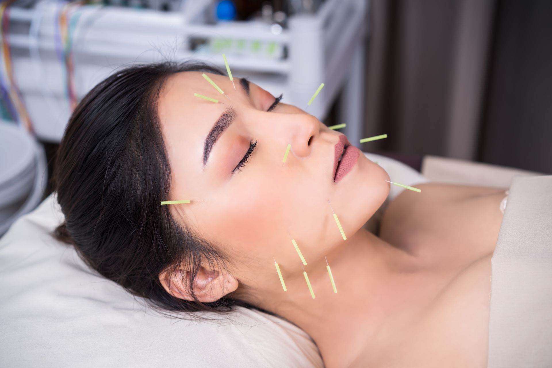 a woman is getting acupuncture on her face in a spa .