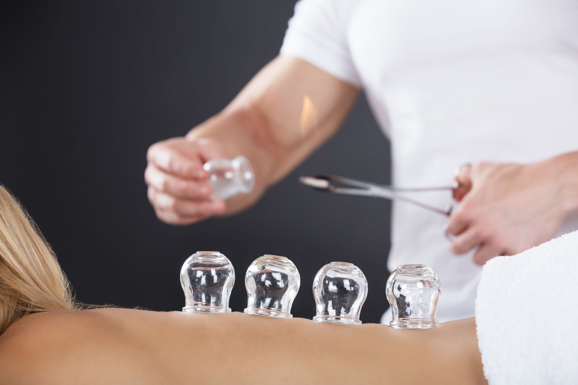 Glass cupping therapy cups placed on a woman's back.