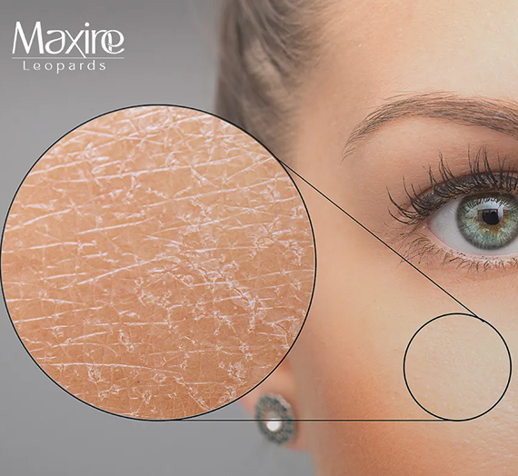 A close-up of skin texture showing dryness and flaking, with a magnified circular inset against a partial human face.