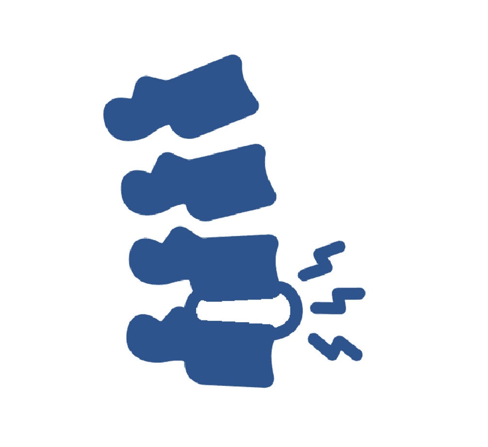 Blue spine with a herniated disc and pain indicators.