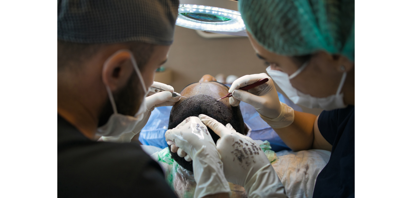 A picture of Hair Transplants Birmingham independent surgeons undertaking a FUE hair transplant