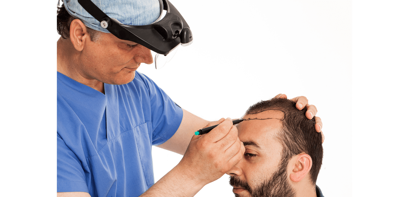 A picture of a Hair Transplant in Birmingham independent surgeon preparing a client for surgery