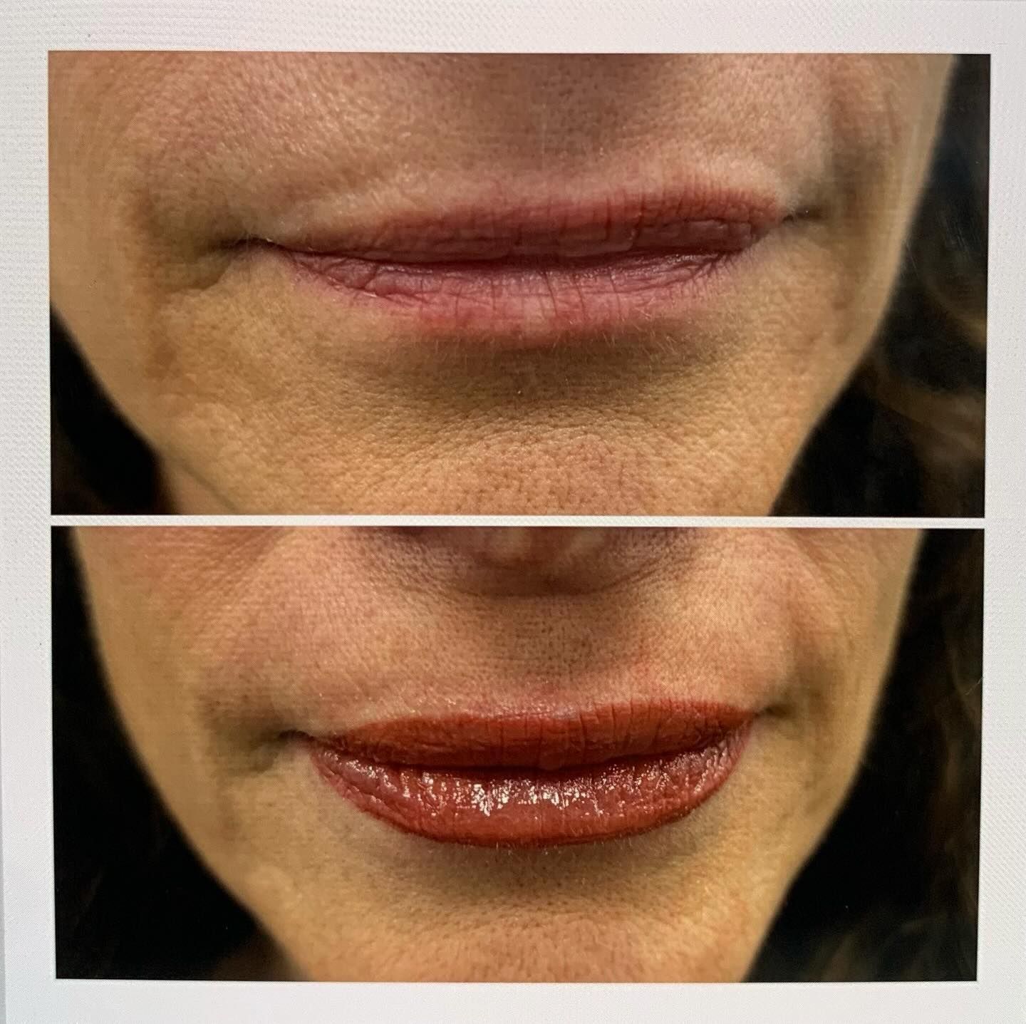 A before and after photo of a woman 's lips.