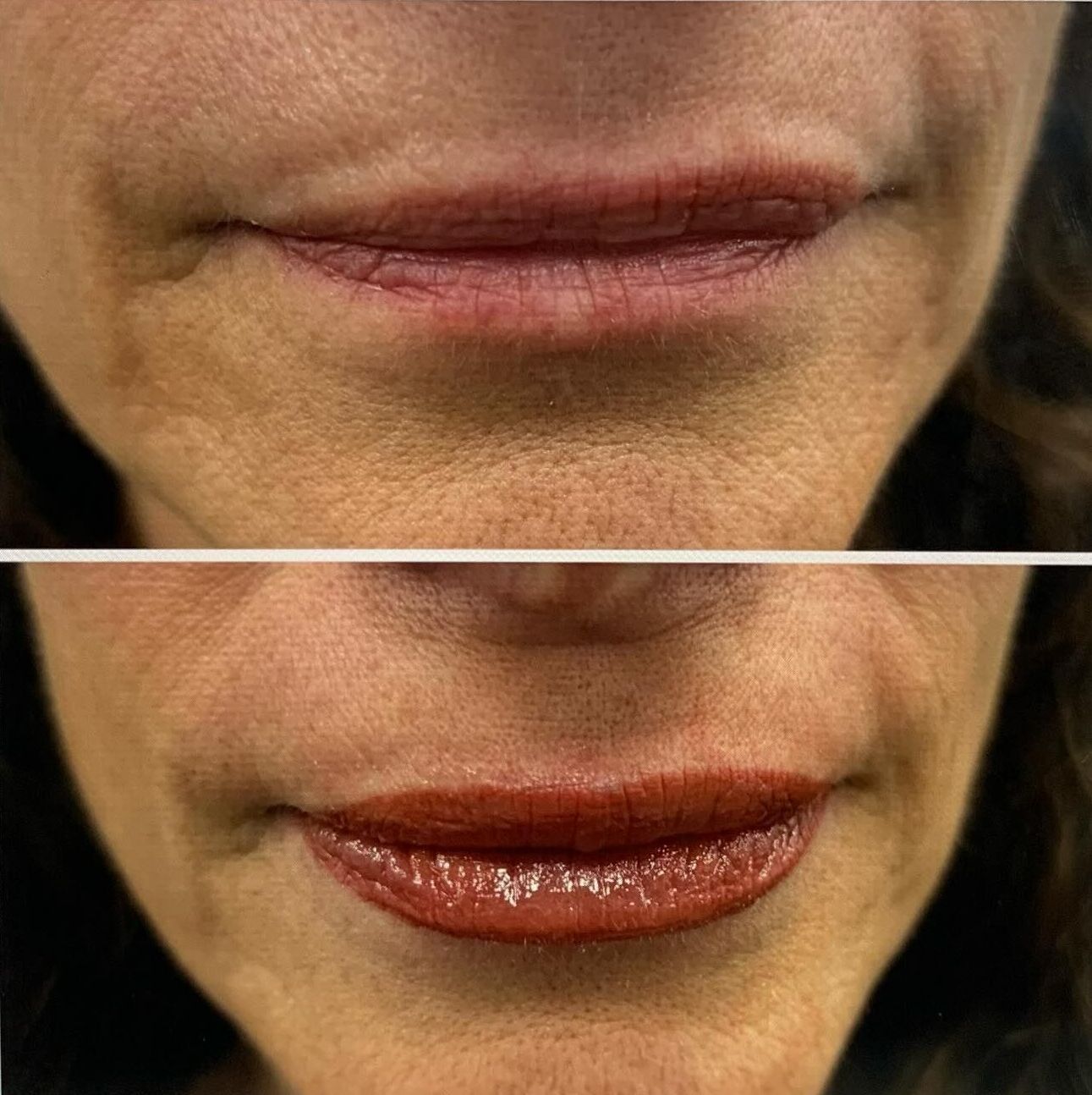 A before and after picture of a woman 's lips.