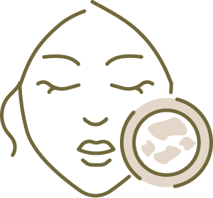 Melasma and Hyperpigmentation