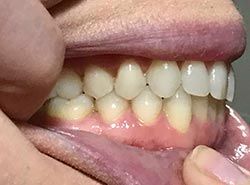 A close up of a person 's mouth with white teeth.