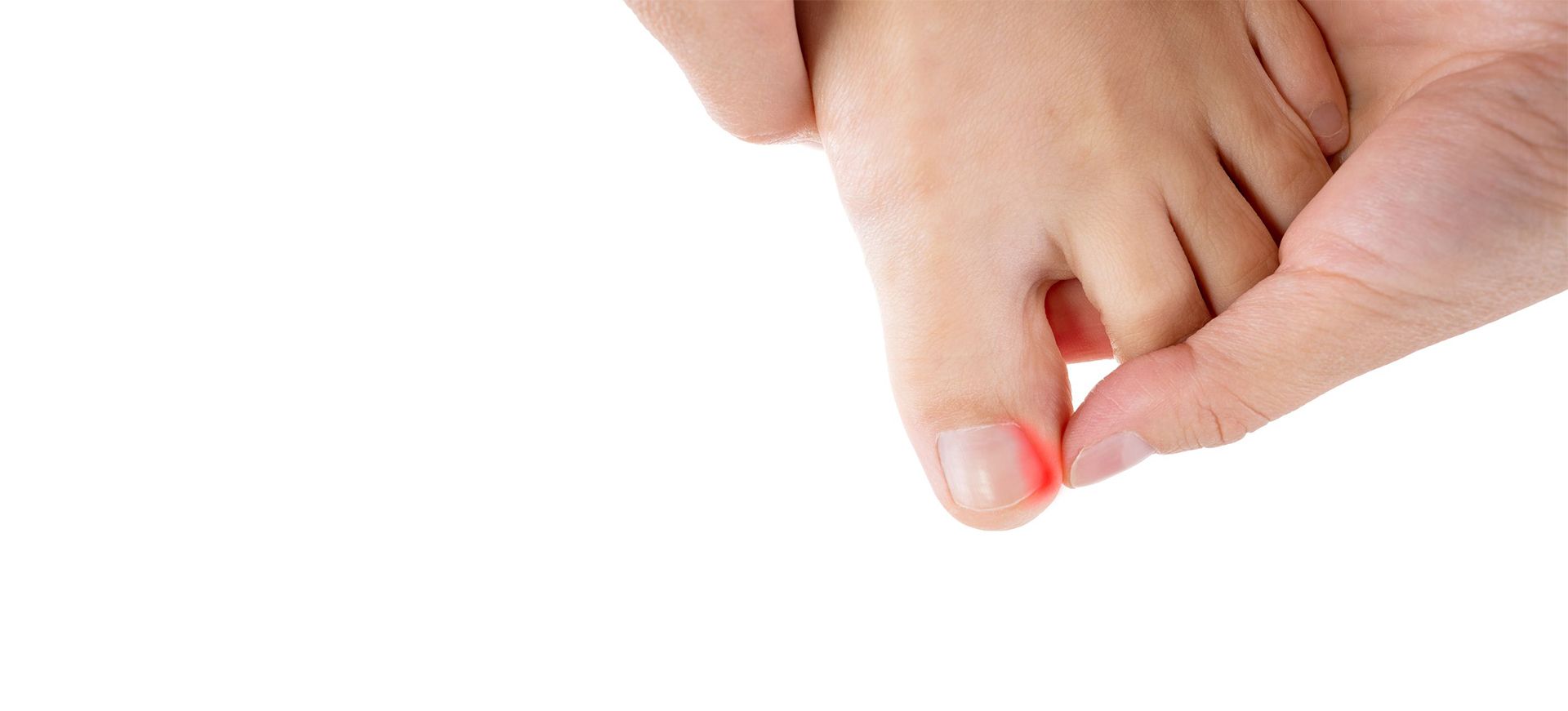 Ingrown Toenail Solutions New Zealand Ingrown Toenail Experts