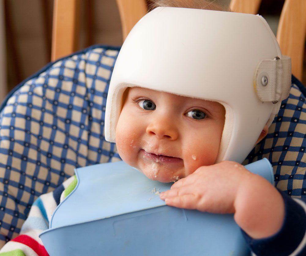 Baby With Cranial Helmet — Bullhead City, AZ — J.L. Artificial Limb & Brace