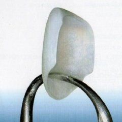 Corona dentale in ceramica