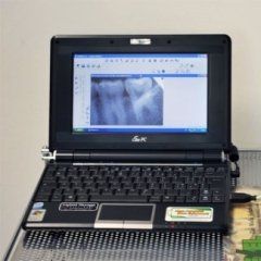 Computer con panoramica dentale