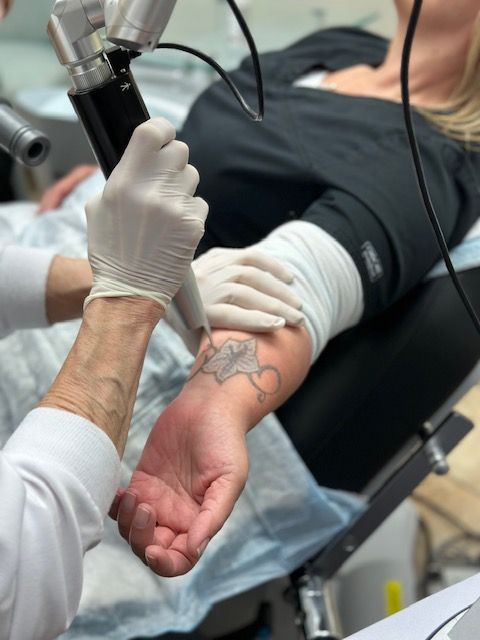 The World's Tattoo Removal Experts (@removery) • Instagram photos and videos