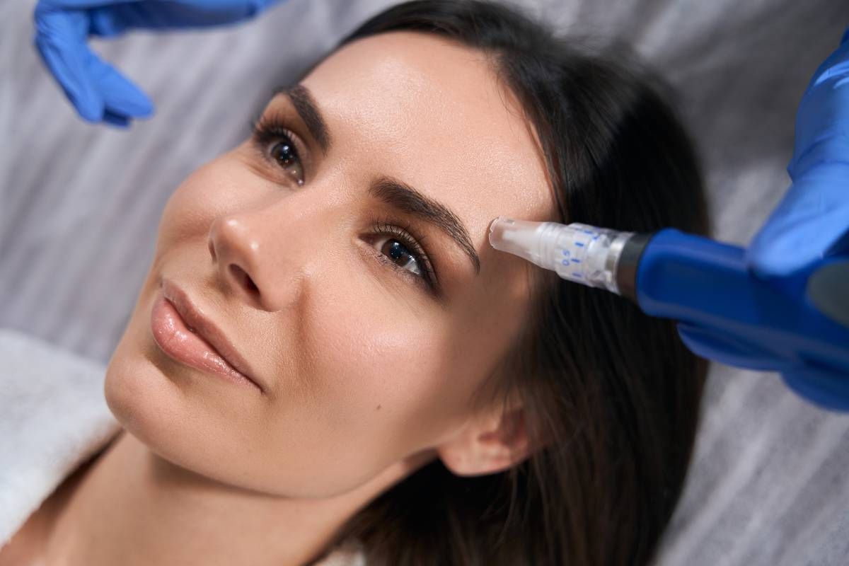 Woman receiving microneedling treatments near Lexington, London, Richmond, Pikeville, and Paris, Kentucky (KY)