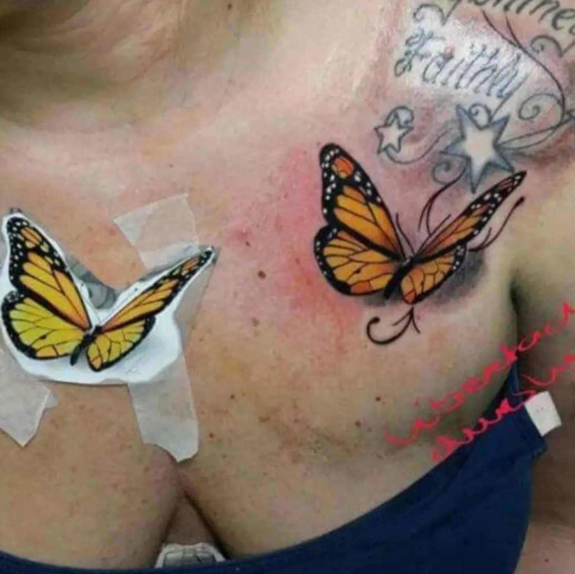 Een borsttatoeage van twee monarchvlinders, waarvan één vers is en de ander een ontwerp is over een chirurgisch litteken; met scripttekst en een ster.