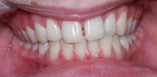 Close-up of a smiling mouth with white teeth and pink lips