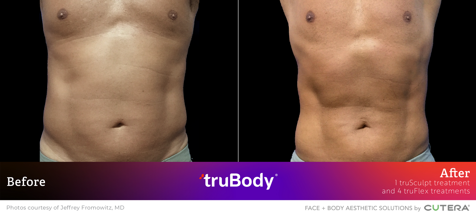 A before and after photo of a man 's torso.
