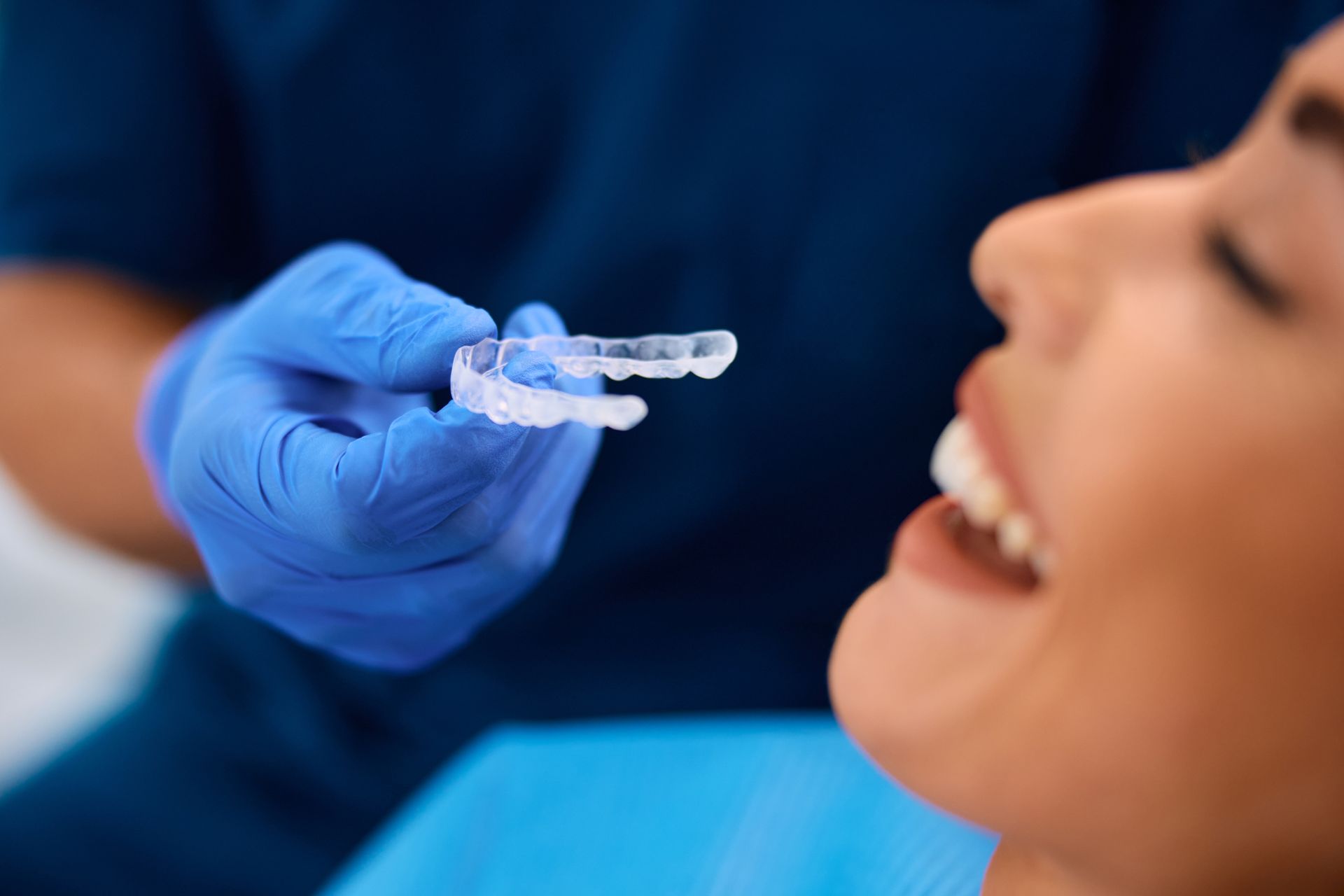 Clear aligners | Discreet and effective clear aligners in Friendswood, TX for a straighter smile.