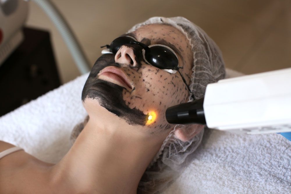 Woman with carbon facial on her face — Shepparton Skin & Body