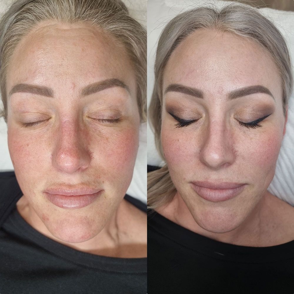 Before and after photo of woman getting brows and lashes treatment — Shepparton Skin & Body