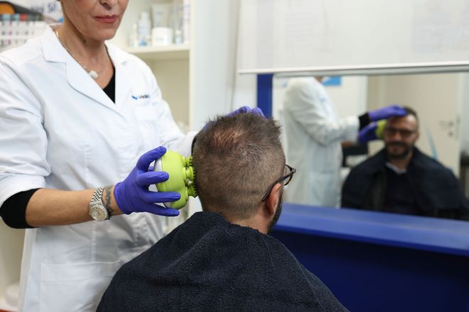 Specialista che applica un trattamento non chirurgico per la caduta dei capelli