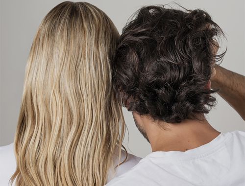 Differenze nella caduta dei capelli tra uomo e donna nelle diverse zone del cuoio capelluto