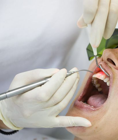 Laser Dentistry - Charlotte, NC - Northlake Dentistry