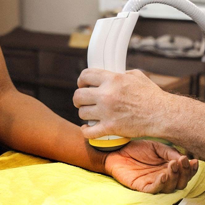 a person is getting softwave therapy on their arm