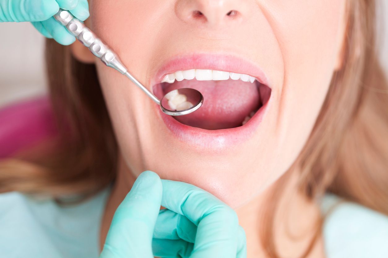 close up of dentist checking patient's dental filling at dentist's office